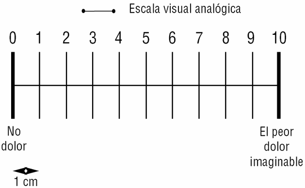 Escala Visual Analógica